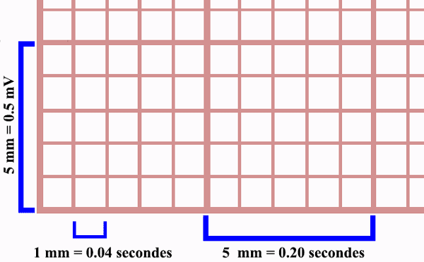 Dimensions du papier de l'électrocardiogramme