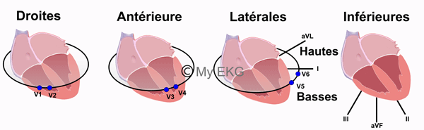 Corrélation entre parois cardiaques et dérivations de l'électrocardiogramme